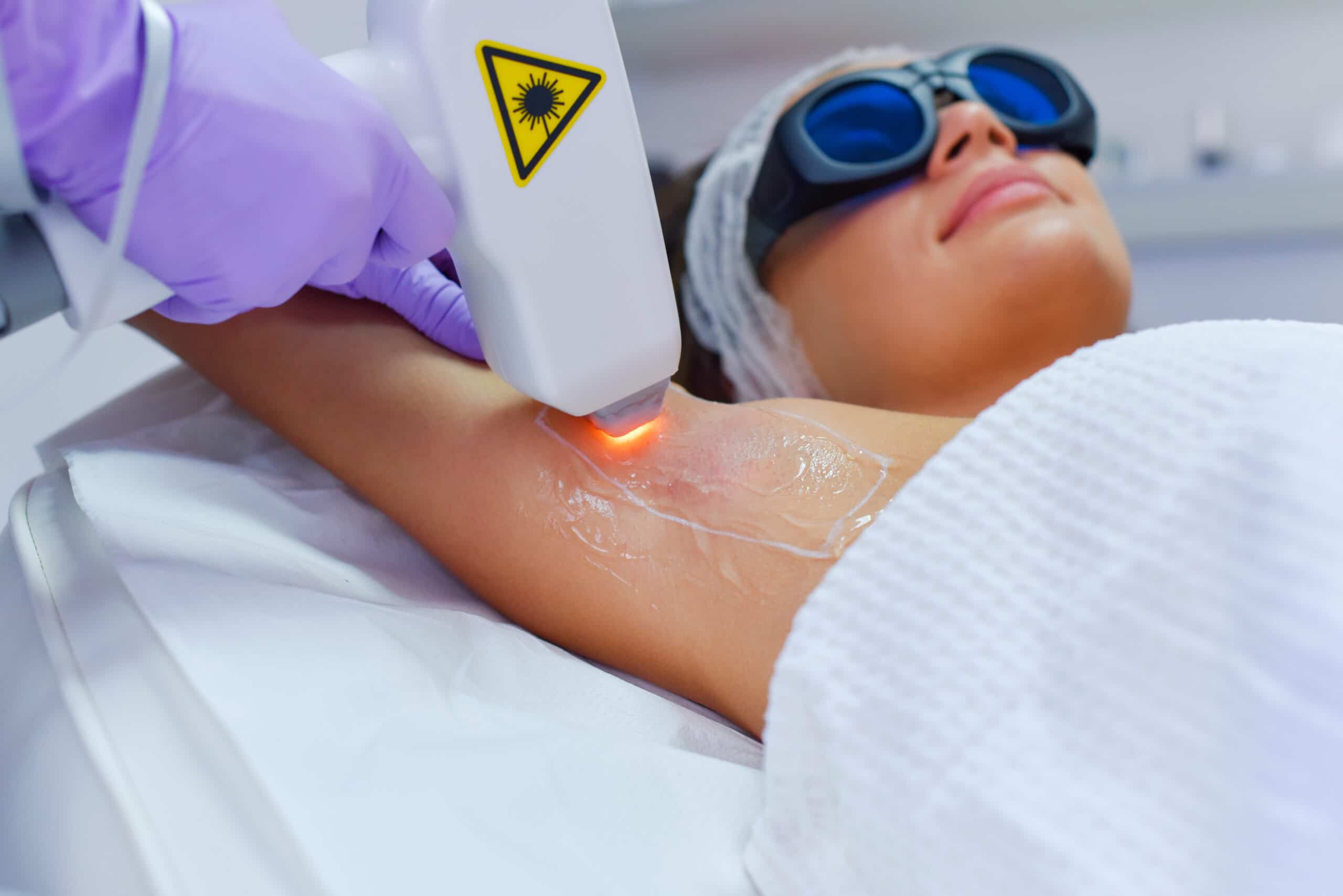 Derby's Laser Hair Removal Revolution: Say Goodbye to Unwanted Hair